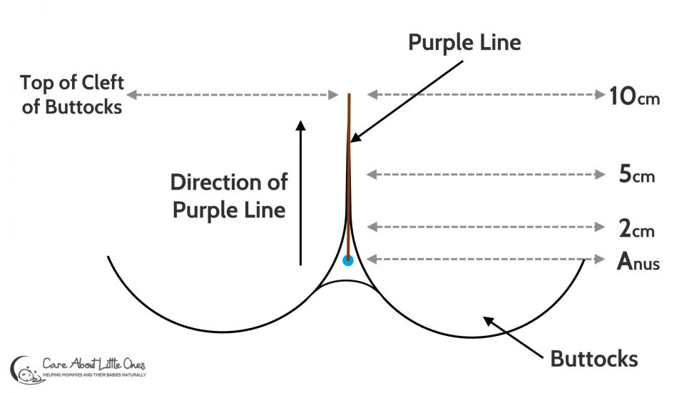 The Purple Line Find Out If You Are Dilating Care About Little Ones